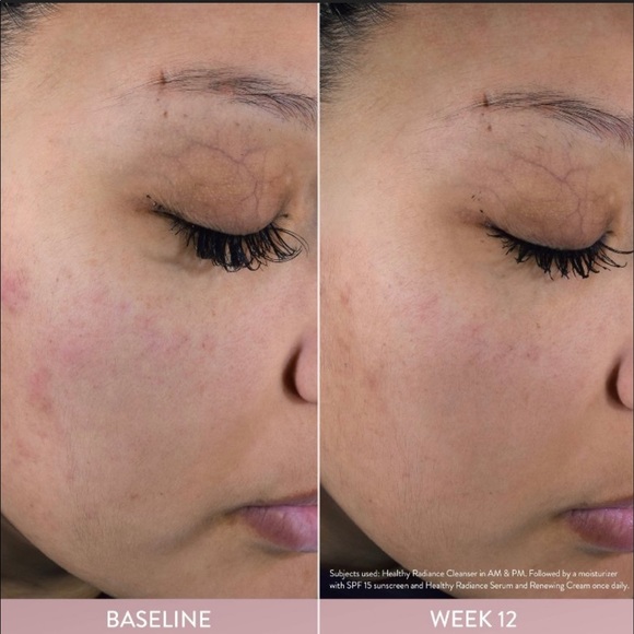 Cetaphil Healthy Radiance Gentle Exfoliating Cleanser Reduces Look of Dark Spots - Picture 3 of 3